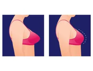 Plastic Surgery Nashik